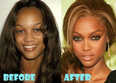 Tyra Banks before and after nose job.